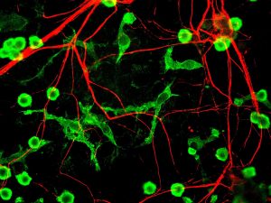 1280px-microglia_and_neurons