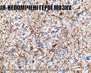 Непомічені герої мозку